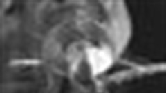 'Needle-free' intervention as natural vaccine against malaria