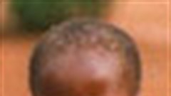 Drugs can save African infants' lives