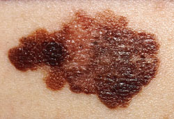 (Image: Wikimedia Commons)