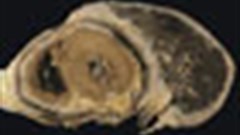 UK ruling opens door to mesothelioma sufferers