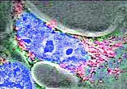 Human embryonic kidney cells were used to test the DNA cages.