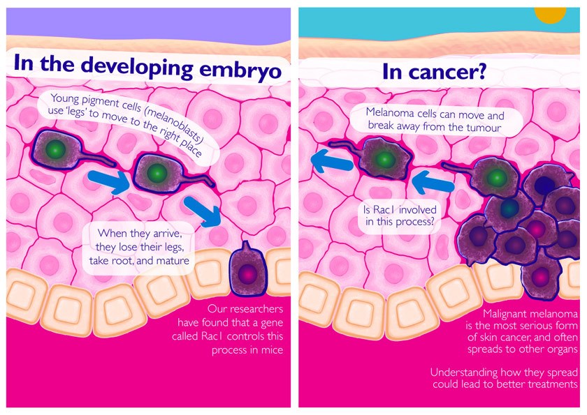 Protein prompting cells to sprout legs could cause skin cancer to spread