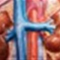 Biomarkers assist in detecting life-threatening kidney injury after cardiac surgery