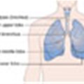 People fail to list persistent cough as a lung cancer warning