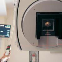 Some children with Hodgkin's lymphoma 'could be spared radiotherapy'