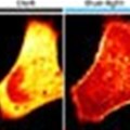 A flash of light changes cell activity - and understanding of disease