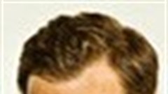 NYF International Advertising Awards/Berlin School of Creative leadership scholarship: The winner