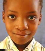 Michelle Abrahams after surgery - what a difference.