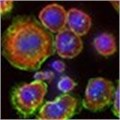 Shape-shifting cells help skin cancer spread