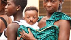 Operation Smile receives fuel sponsorship from Engen