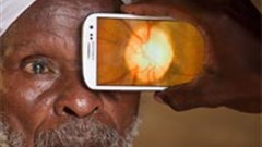Transforming a smartphone into an eye test kit