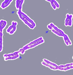 (Image: Wikimedia Commons)