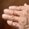 Rheumatoid arthritis compromises patients' careers