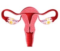 Pregnancy risk may be higher with newer method of female sterilization