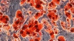 Deciphering the role of fat stem cells in obesity and diabetes