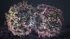 Scientists find new way to combat drug resistance in skin cancer