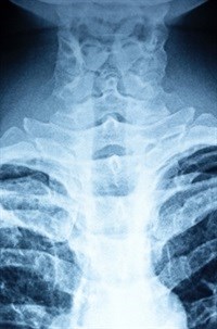 Image courtesy of hin255 at FreeDigitalPhotos.net