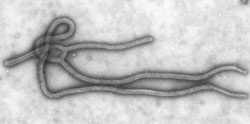 The Ebola virus. (Image: Wikimedia Commons)