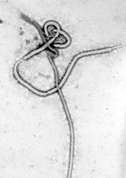 The Ebola virus. (Image: Wikimedia Commons)