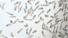 Merck supports schistosomiasis education in Mozambique