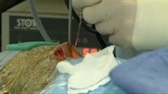 China-Africa Health Collaboration focused on universal health coverage