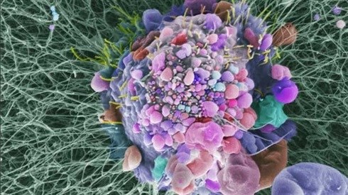 Melanoma cell. Credit: Dr Erik Sahai