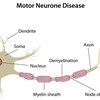 Wits profs will use new method to treat neuron diseases