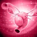 Sparing ovaries and removing fallopian tubes may cut cancer risk, but few have procedure