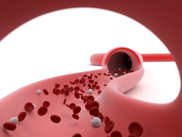 Researchers link lipids to one third of myelomas