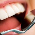 Minister to amend scope of dental therapists