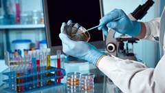 Large study targets prostate cancer in black men