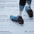 Tweets encourage double amputee teen to walk again