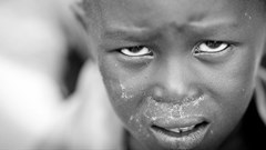 WHO fights battle against disease in war-torn South Sudan