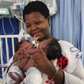 Uwenzile and Uyihlelile Shilongonyane with their mom, Bongekile Simelane, minutes before they underwent their separation surgery .