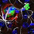 Limiting lung cancer's spread and growth in the brain