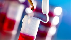 DR Congo declares end of Ebola outbreak