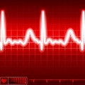 No - heart disease is not SA's leading cause of death