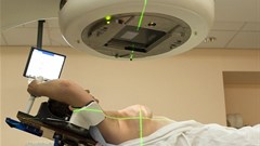 Breast reconstruction and radiation therapy - is it really safe?