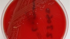 A lab sample of the bacteria listeria monocytogene that causes listeriosis.