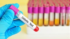 WHO offers regional support in listeriosis crisis