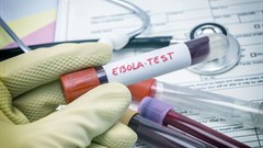 Ebola outbreak in DRC: Are we better prepared this time?