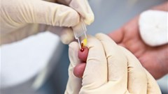 Response to HIV needs to change