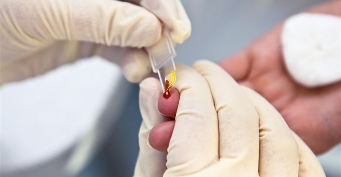 Response to HIV needs to change