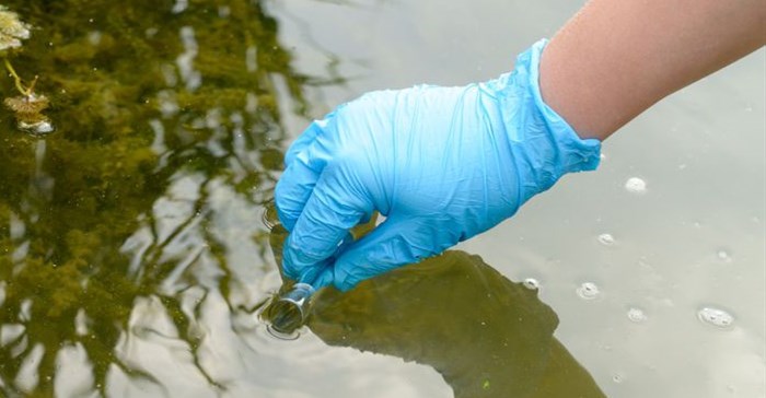 Red Cross steps in to curb cholera and typhoid in Zim