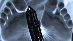 Zim only has two pathologists