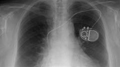 Why medical devices should carry warranties