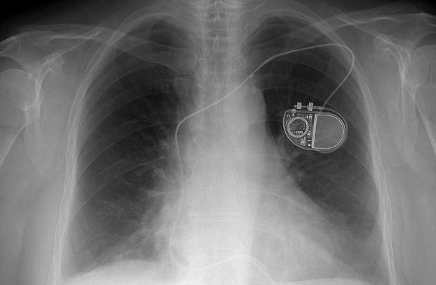 Why medical devices should carry warranties