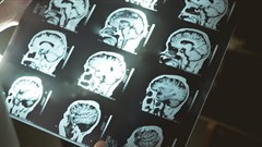 There are concerns that Africa may be excluded from advances in genetic brain research. Shutterstock