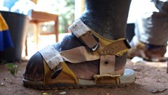 New drug regimen to treat lymphatic filariasis