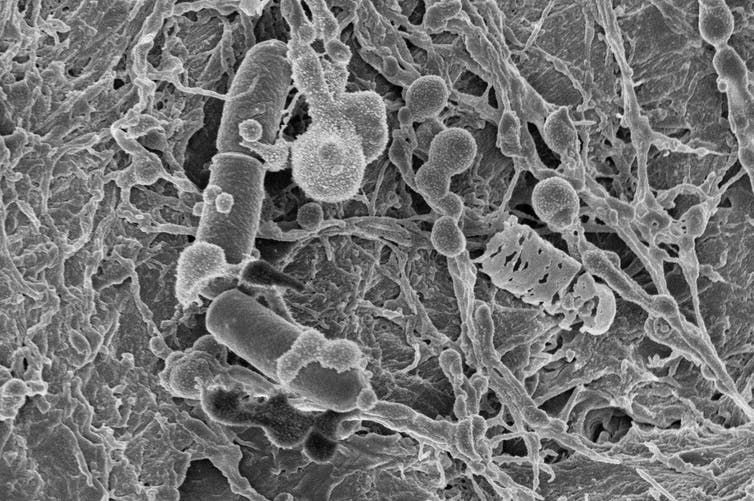 Raster Electron Microscopy picture of microbes on the human skin as part of an artscience project Fifty Percent Human. Sonja Bäumel